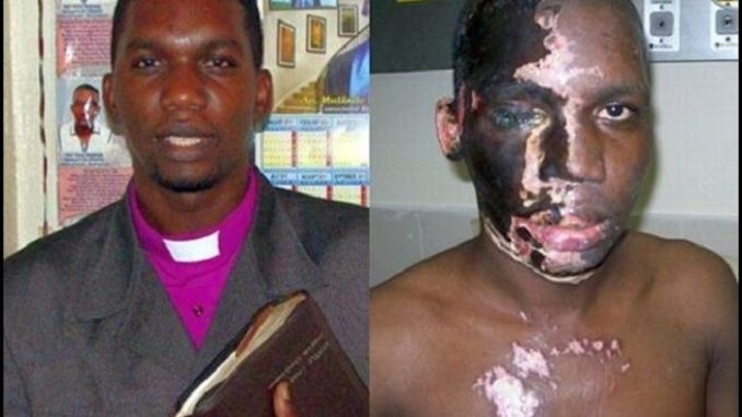 A Christian pastor who was attacked with acid by Muslims shouting "Allahu Akbar" has survived the harrowing ordeal and now has an important message to share with the entire world. 