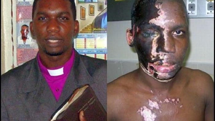 A Christian pastor who was attacked with acid by Muslims shouting "Allahu Akbar" has survived the harrowing ordeal and now has an important message to share with the entire world. 