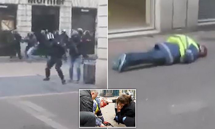 Anti-Macron protestor shot in the back of the head by police