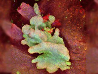 Scientists discover 'cell of origin' responsible for every form of cancer