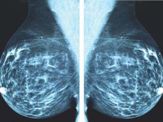 X-ray Mammography is accelerating cancer epidemic, top doctor warns