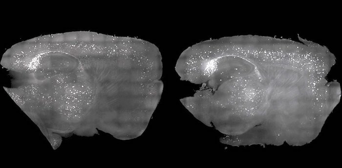 Scientists clear alzheimer’s plaque in mice using light and sound