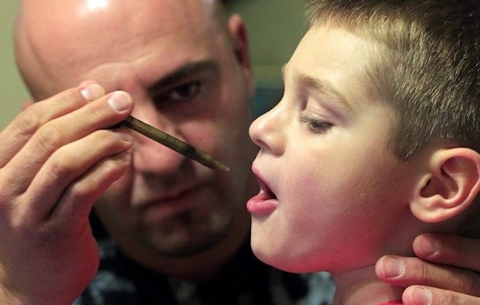 Study suggests cannabis oil can help reduce or eliminate epileptic fits in children