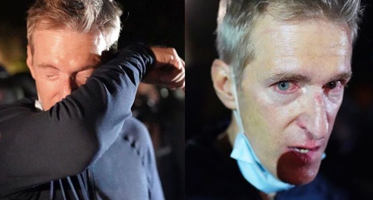 Portland Mayor begs Trump administration for help against Antifa thugs