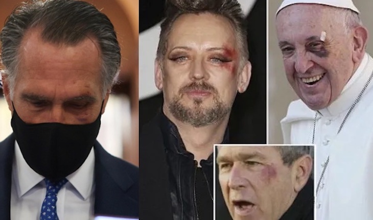 Mitt Romney joins illuminati black eye club