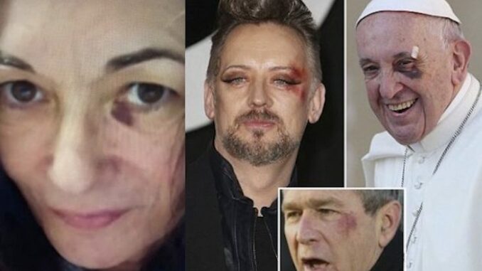 Ghislaine Maxwell joins the illuminati black eye club