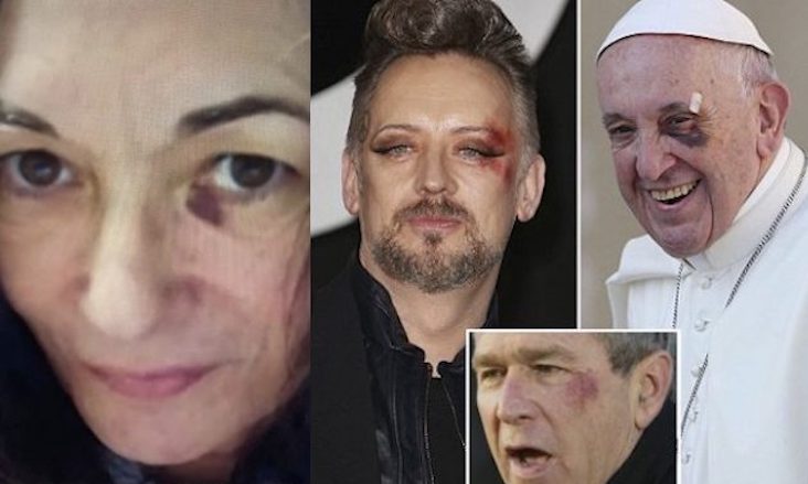 Ghislaine Maxwell joins the illuminati black eye club