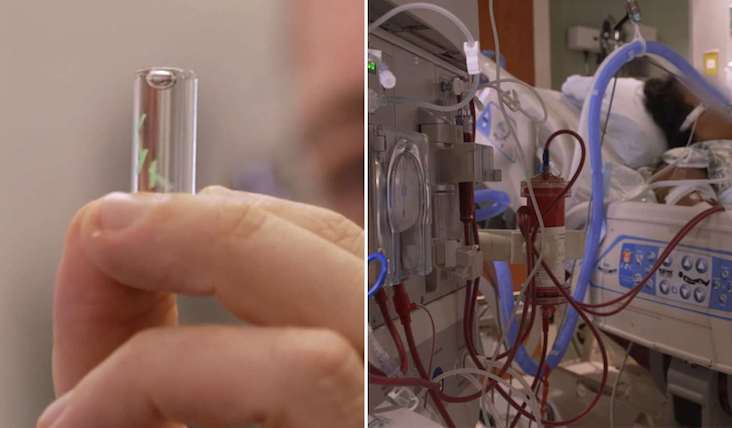 Pentagon scientists invent microchip which can detect COVID-19 in the body