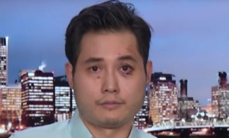 Antifa try to murder Andy Ngo for the second time