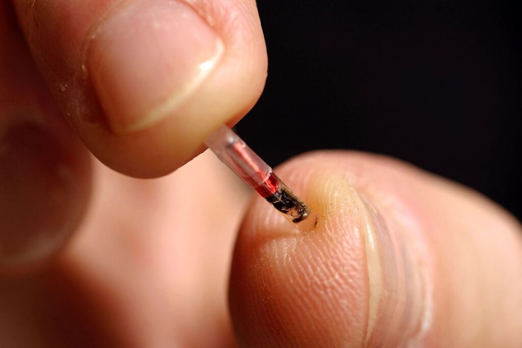 microchip implant