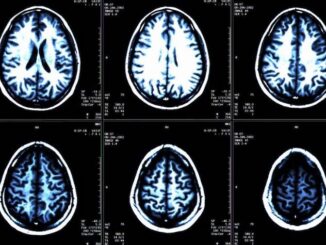 'Mystery' neurological illness sweeps across Canada