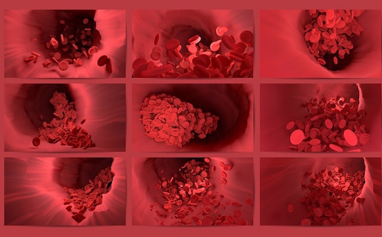 Pfizer and CDC issue joint warning about blood clots