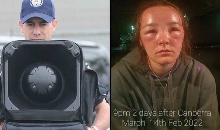 Australian authorities caught attacking non-compliant citizens with Directed Energy Weapons