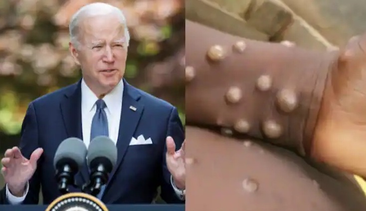 President Joe Biden warns that monkeypox pandemic is coming in time for the midterms