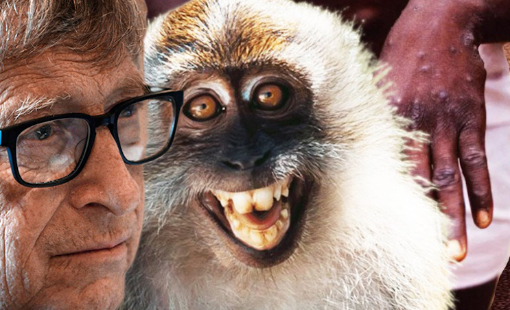 Bill Gates ran wargame that stimulated global monkeypox pandemic