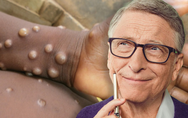 Bill Gates document 'predicted' monkeypox outbreak on May 15, 2022