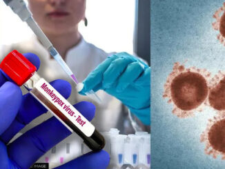 ECDC warns monkeypox appears to be leaked from a lab