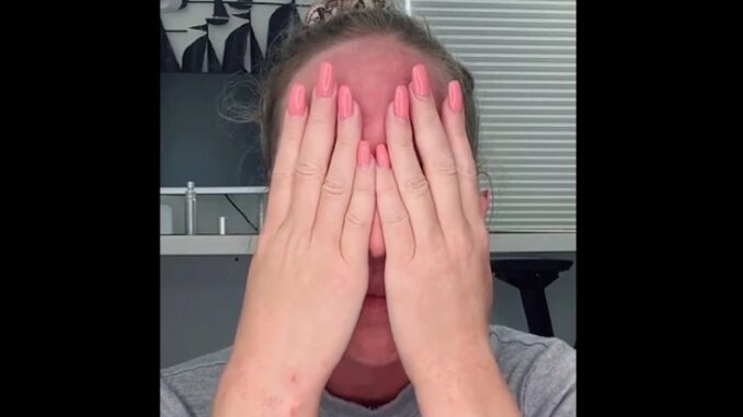 Woman sobs are vaccine injury results in her face melting off
