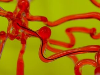 Embalmers keep finding long, rubbery clots inside corpses of fully jabbed individuals
