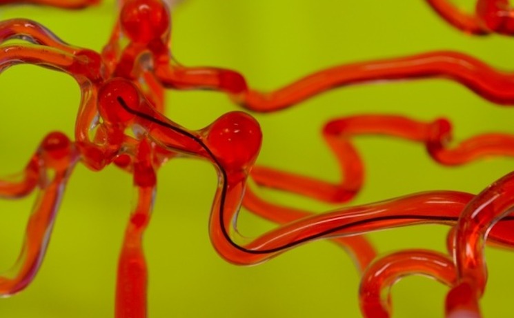 Embalmers keep finding long, rubbery clots inside corpses of fully jabbed individuals