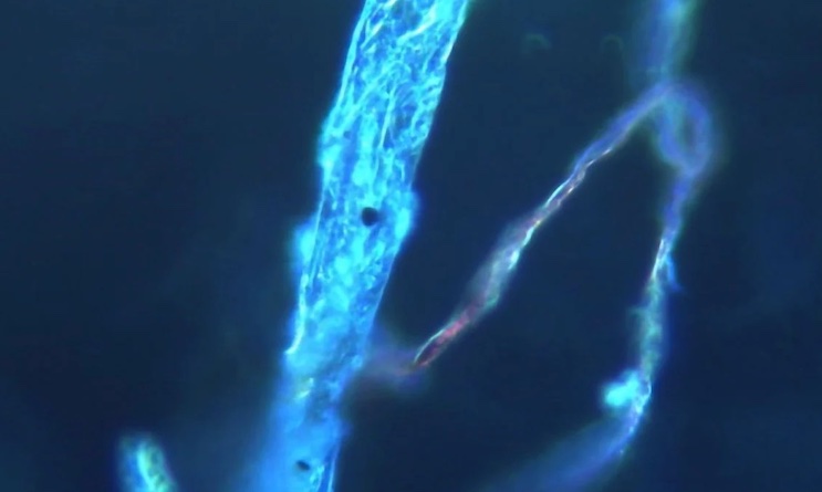 Peer-reviewed study out of Italy shows metallic objects inside jabbed people