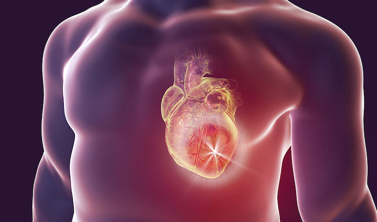 CDC admits jabs do cause myocarditis