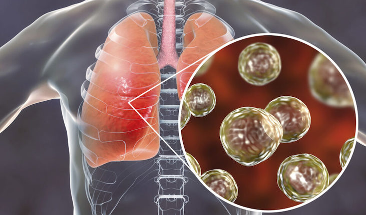 Scientists warn climate change is suddenly causing people to drop dead