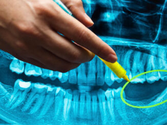 Dentists warn that vaxxed patients are beginning to lose their teeth