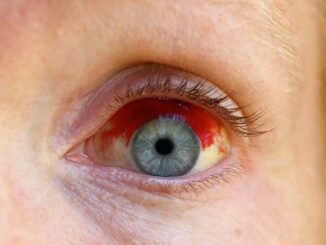 Official study says COVID jabs cause eye blindness