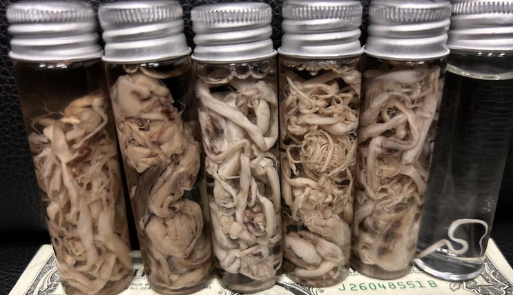 Embalmer reveals over 50 percent of bodies now contain fibrous blood clots since jab rollout