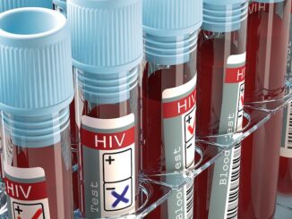 ACLU files lawsuit to allow criminals to intentionally spread HIV