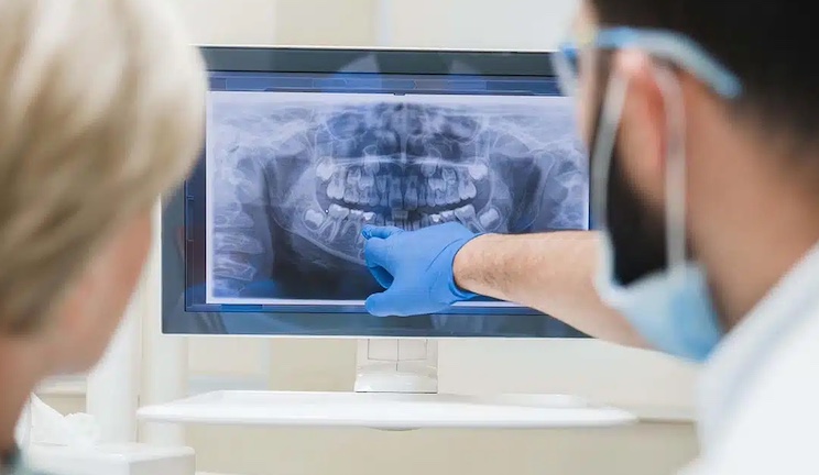 Millions experiencing a lifetime of bone loss one year post COVID vaccination