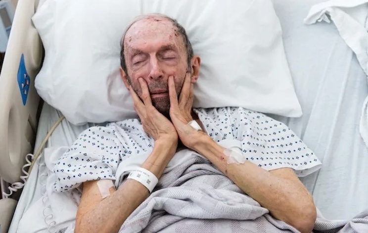 US government admit COVID jabs have caused massive surge in disabilities