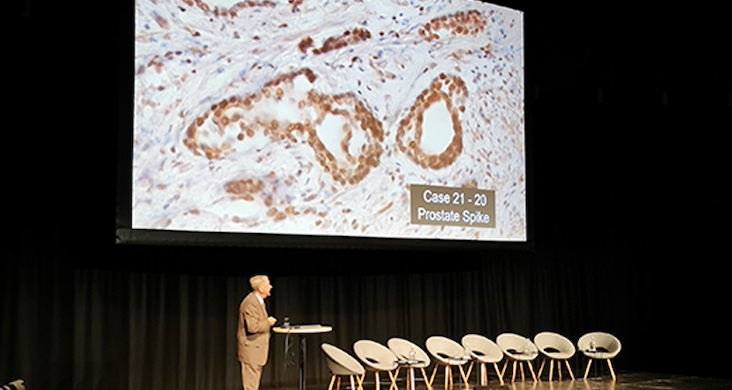 German official warns spike protein is replacing sperm in vaxxed men