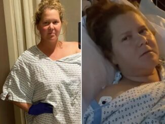 Amy Schumer reveals she developed VAIDS after getting vaccinated for COVID.