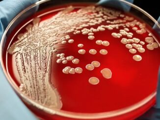 Super gonorrhea to be next pandemic out of China, CDC warns.