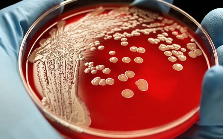 Super gonorrhea to be next pandemic out of China, CDC warns.