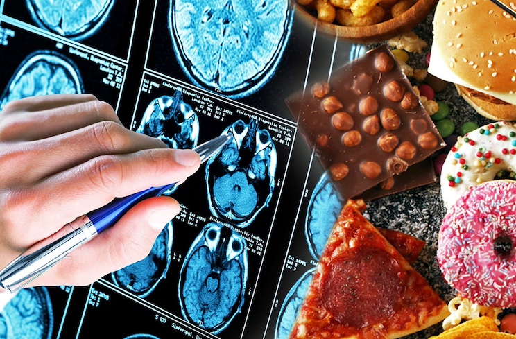 Study concludes processed foods cause dementia
