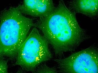 Aussie government covered-up evidence that mRNA jabs infect brain, liver and ovaries.