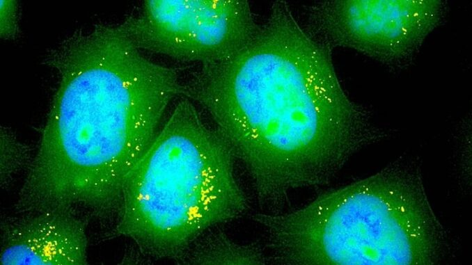 Aussie government covered-up evidence that mRNA jabs infect brain, liver and ovaries.