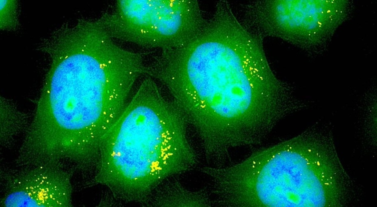 Aussie government covered-up evidence that mRNA jabs infect brain, liver and ovaries.