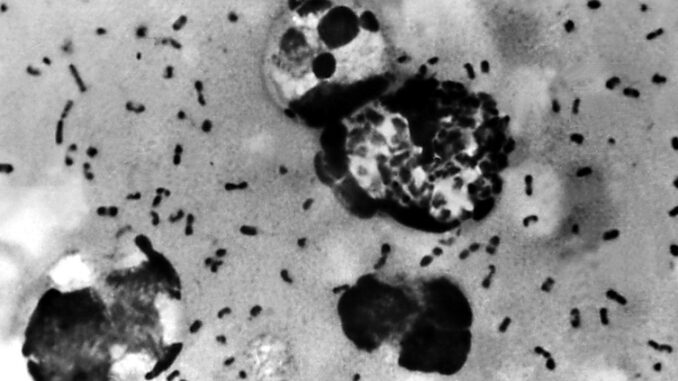 CDC warns of imminent plague coming to America.