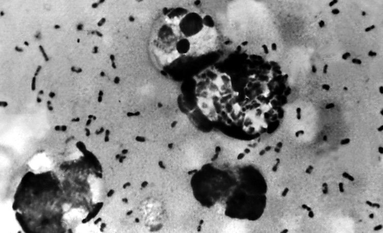 CDC warns of imminent plague coming to America.