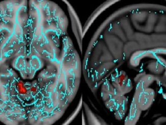 Study reveals nanoparticles in vaccines alter brain activity.