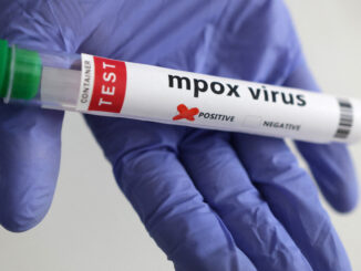 MPOX VIRUS