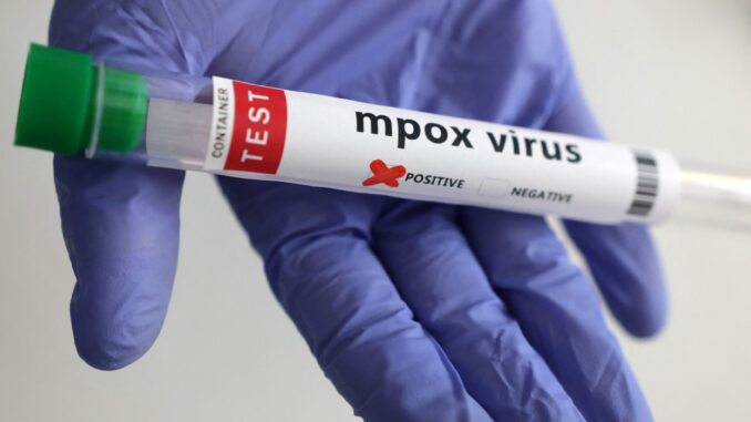 MPOX-VIRUS