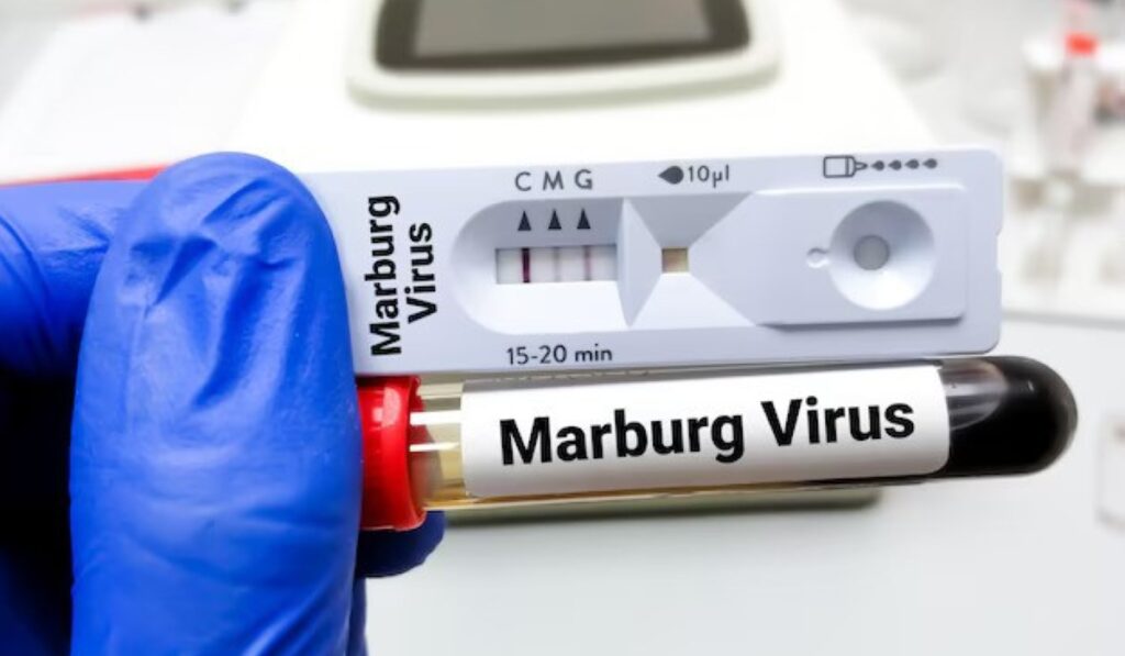 marburg virus