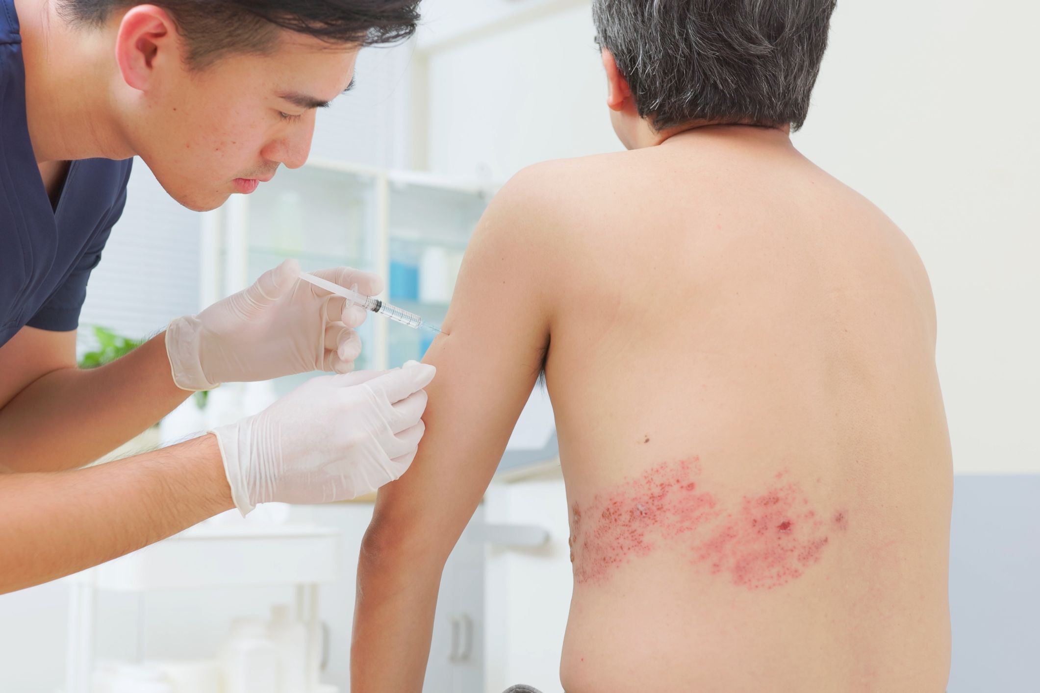 New Study Reveals People Vaccinated Against Shingles 15X More Likely to Develop Shingles