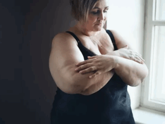 Study says breast cancer is caused by obesity.