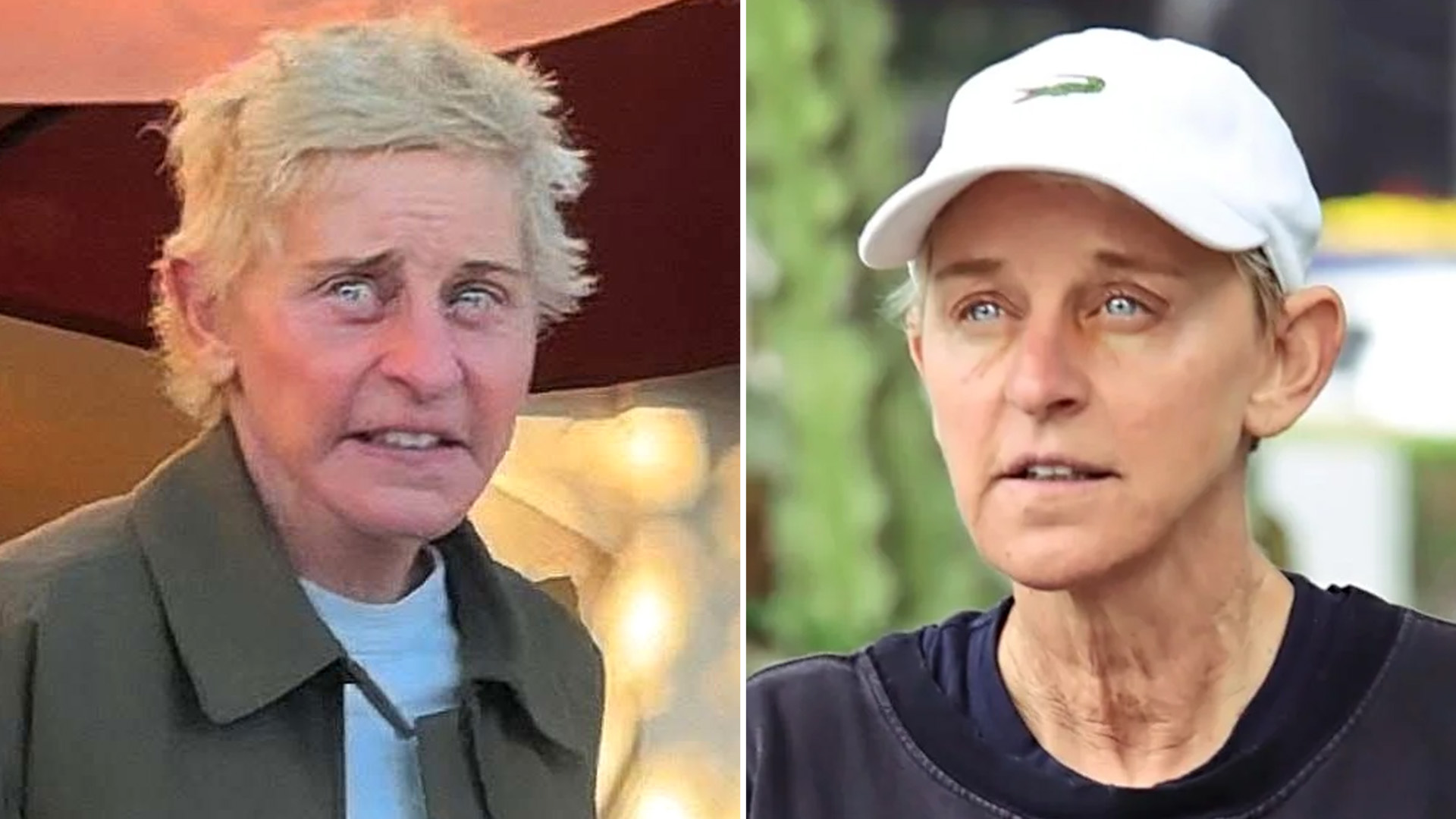 Ellen DeGeneres ‘Going Blind’ in Horrific Kuru Nightmare — Epstein Files Reveal She Ate ‘Dozens of Kids’